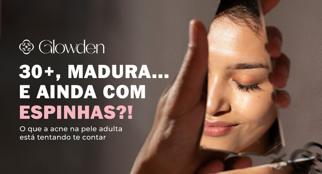 30+, madura… e ainda com espinhas? O que a acne na pele adulta está tentando te contar