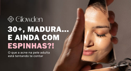 30+, madura… e ainda com espinhas? O que a acne na pele adulta está tentando te contar