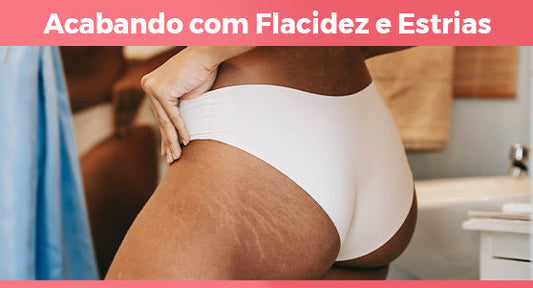 Tchau, estrias: o passo-a-passo natural para uma pele firme e sem manchas