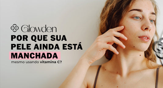 Por Que Sua Pele Ainda Está Manchada Mesmo Usando Vitamina C?
